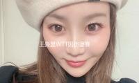 王曼昱WTT因伤退赛 陈幸同晋级决赛将与孙颖莎争冠 — 新京报